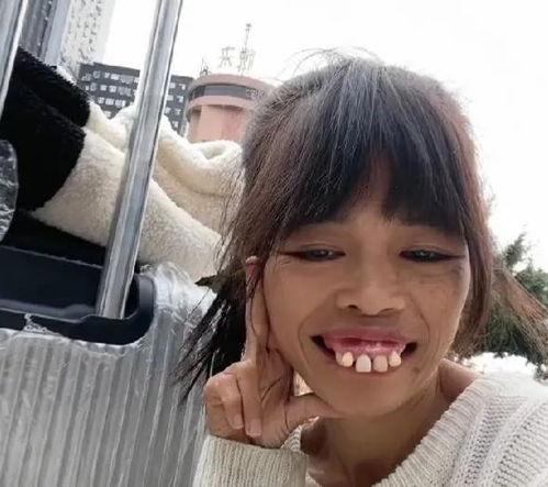 网红 山 矮 龅牙